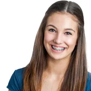 braces cost renton wa