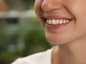 Teeth Gap 