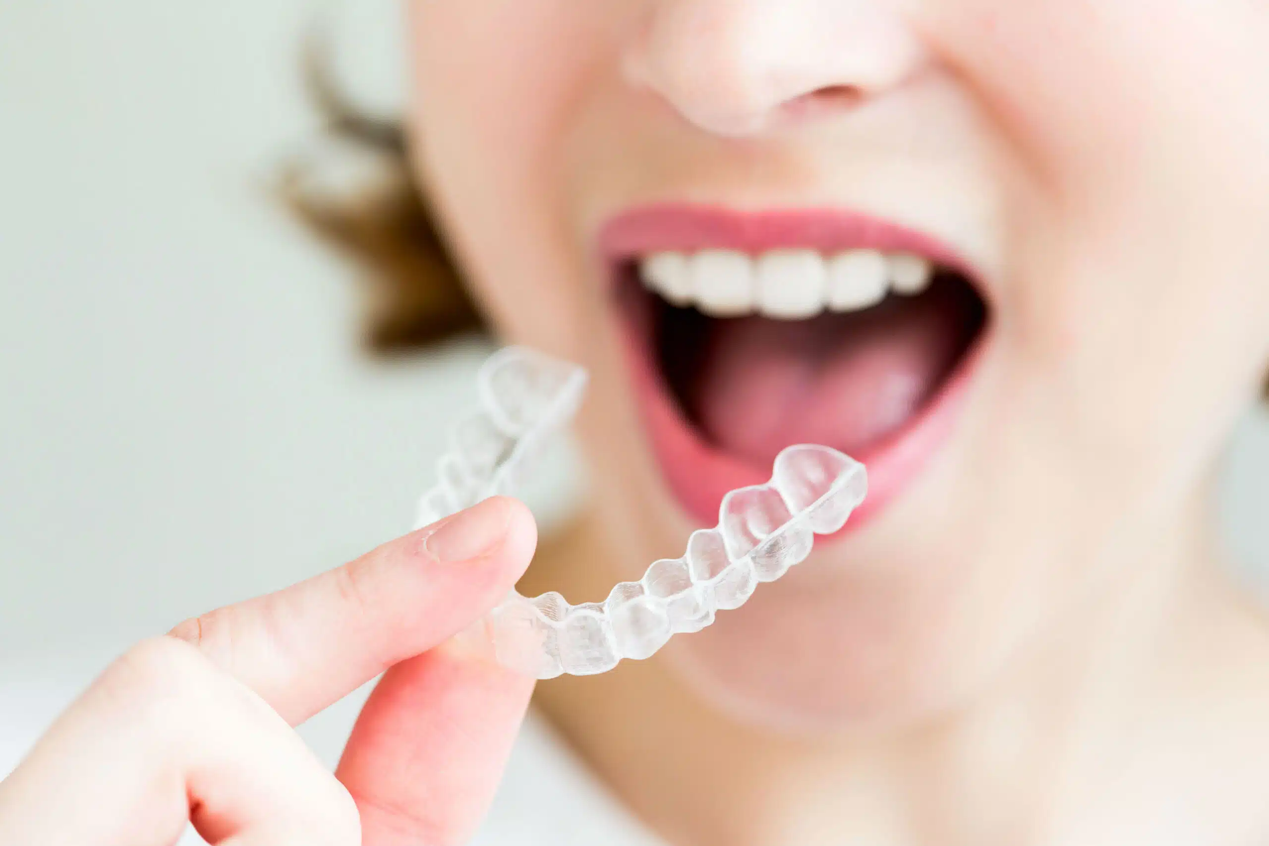 Invisalign for Adults
