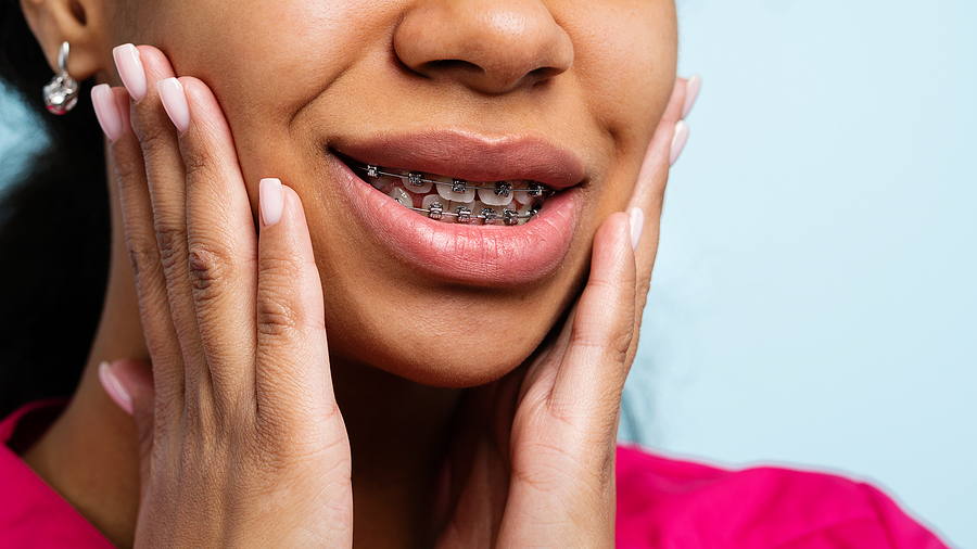 Braces Allergies: Essential Solutions for a Comfortable Treatment