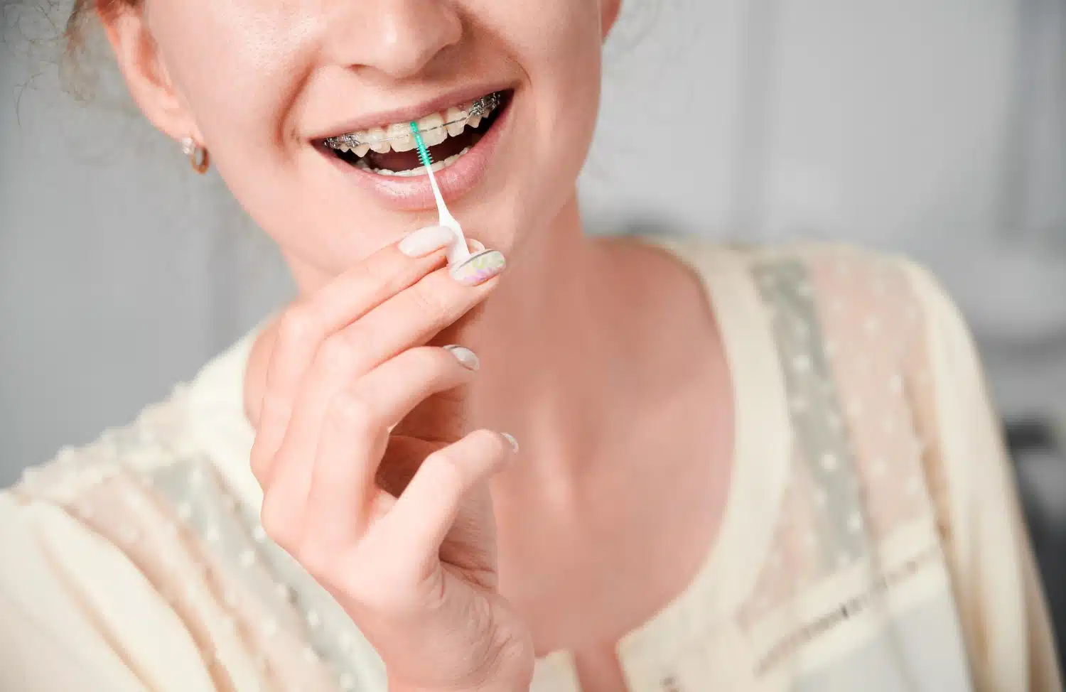 braces maintenance 101