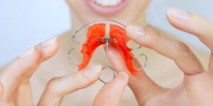 What Is a Palatal Expander? Powerful Benefits for Growing Smiles