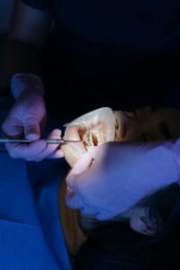 Tooth Decay with Braces: Proven Methods to Keep Cavities at Bay