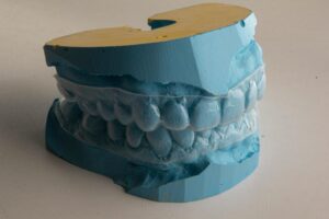 Invisalign Teen for Complex Cases: Proven Solutions That Work