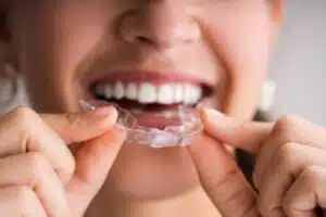 Close-up of a person holding a clear aligner demonstrating clear aligners as an orthodontic treatment option